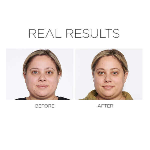 4-in-1 Correcting Primer Anti-Blemish & Mattifying Primer - Image 4