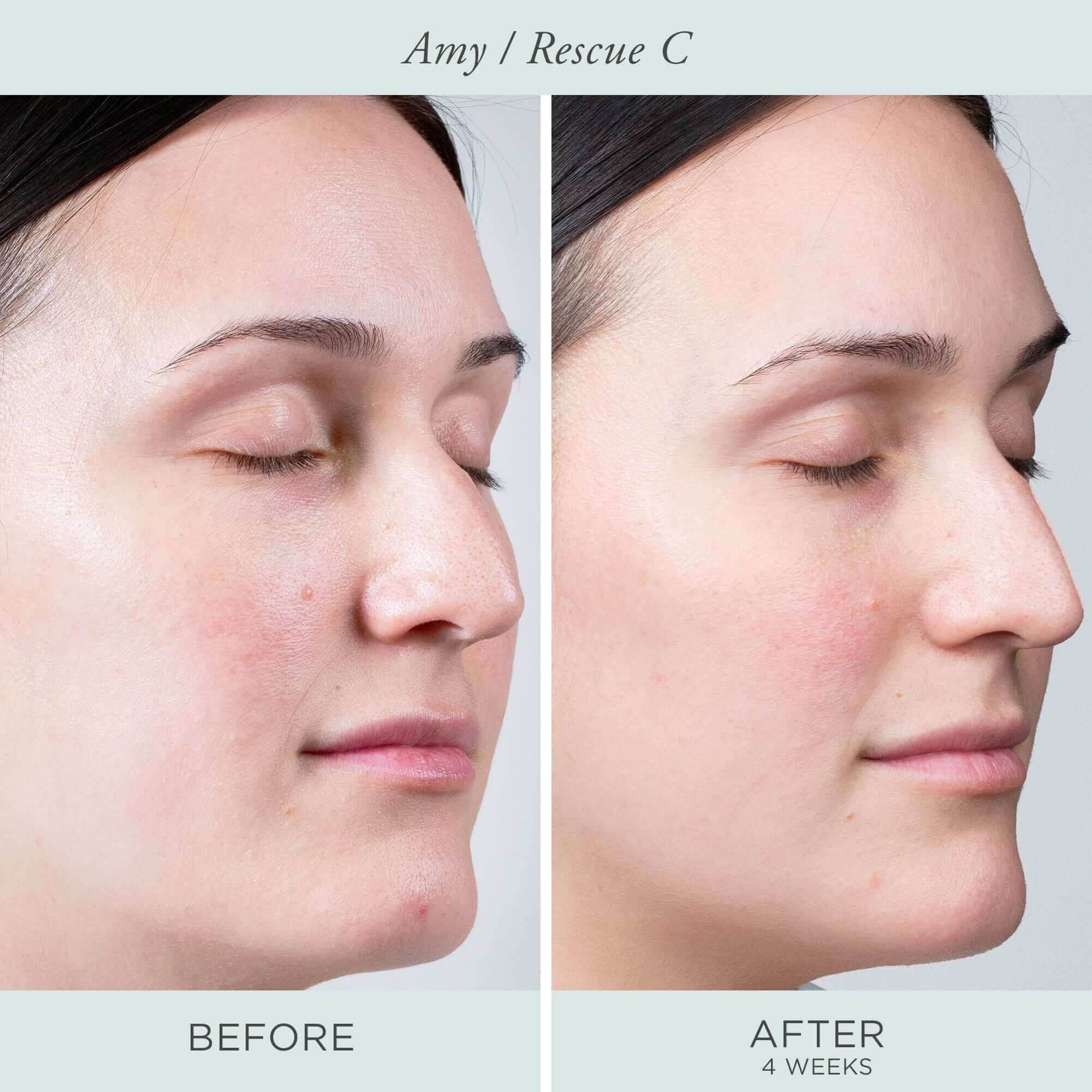 Rescue C Brightening Vitamin C & Peptide Eye Cream - Image 3