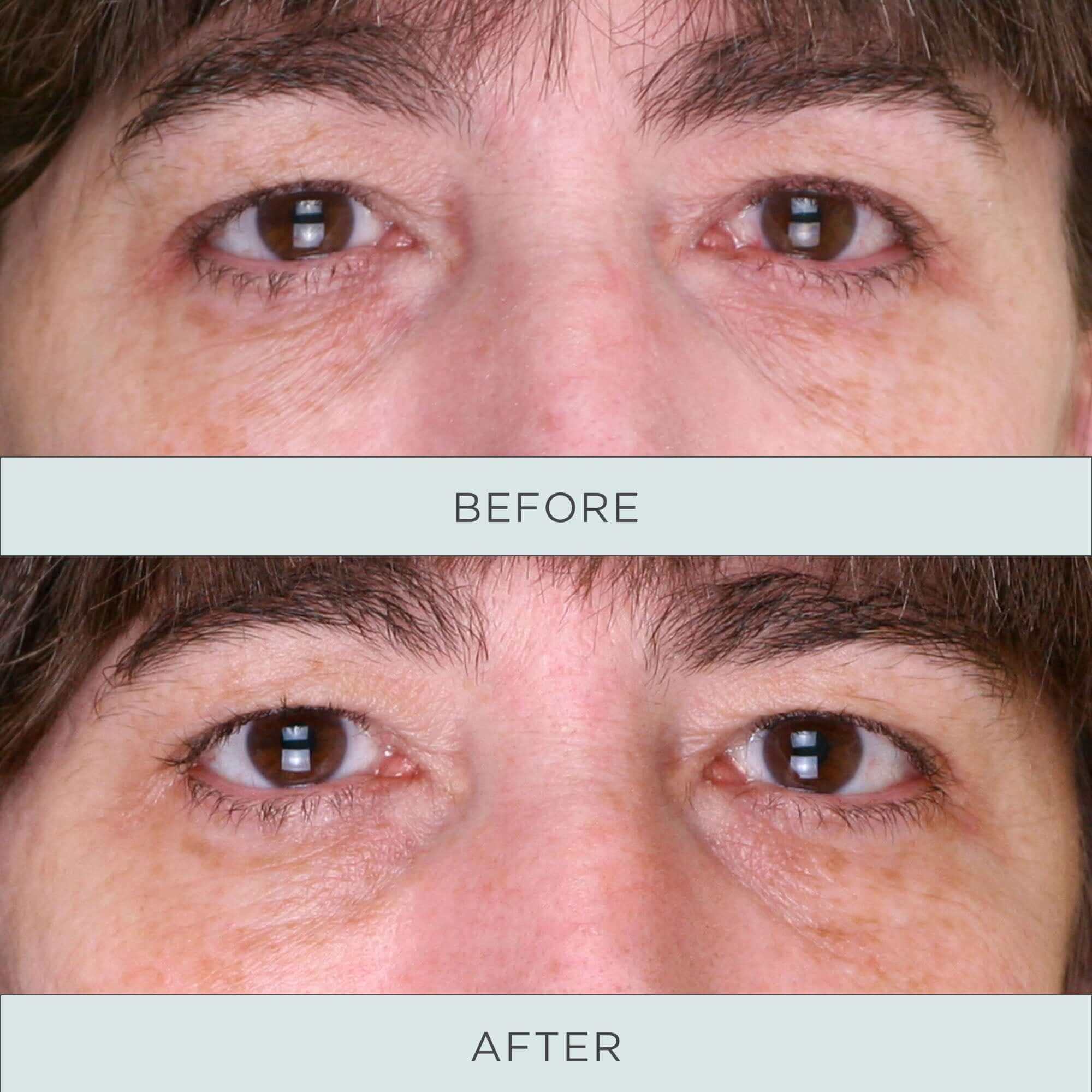 Tone Up Niacinamide Firming Eye Serum - Image 4